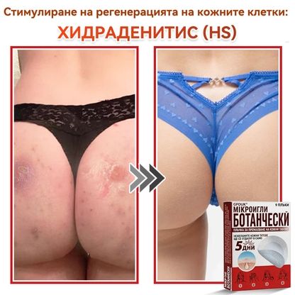 🎁 Остават само 5 пакета! Сега можете да получите допълнителна 50% ОТСТЪПКА! Помага видимо да се намалят фибромите, брадавиците и други кожни несъвършенства — бързо, удобно и безболезнено. 🌿