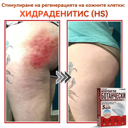 🎁 Остават само 5 пакета! Сега можете да получите допълнителна 50% ОТСТЪПКА! Помага видимо да се намалят фибромите, брадавиците и други кожни несъвършенства — бързо, удобно и безболезнено. 🌿