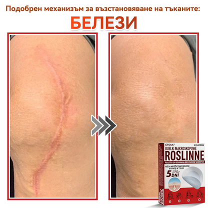 🎁 Остават само 5 пакета! Сега можете да получите допълнителна 50% ОТСТЪПКА! Помага видимо да се намалят фибромите, брадавиците и други кожни несъвършенства — бързо, удобно и безболезнено. 🌿