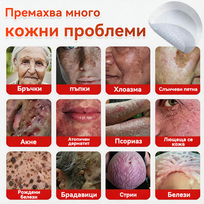 🎁 Остават само 5 пакета! Сега можете да получите допълнителна 50% ОТСТЪПКА! Помага видимо да се намалят фибромите, брадавиците и други кожни несъвършенства — бързо, удобно и безболезнено. 🌿
