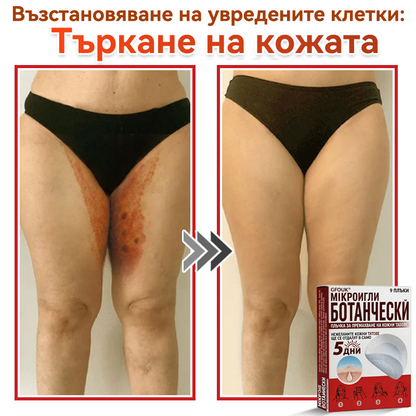 🎁 Остават само 5 пакета! Сега можете да получите допълнителна 50% ОТСТЪПКА! Помага видимо да се намалят фибромите, брадавиците и други кожни несъвършенства — бързо, удобно и безболезнено. 🌿