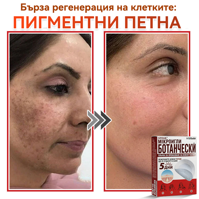 🎁 Остават само 5 пакета! Сега можете да получите допълнителна 50% ОТСТЪПКА! Помага видимо да се намалят фибромите, брадавиците и други кожни несъвършенства — бързо, удобно и безболезнено. 🌿