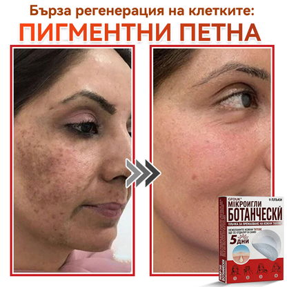 🎁 Остават само 5 пакета! Сега можете да получите допълнителна 50% ОТСТЪПКА! Помага видимо да се намалят фибромите, брадавиците и други кожни несъвършенства — бързо, удобно и безболезнено. 🌿