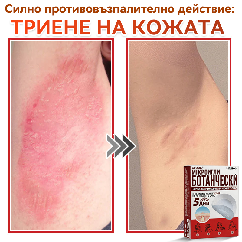 🎁 Остават само 5 пакета! Сега можете да получите допълнителна 50% ОТСТЪПКА! Помага видимо да се намалят фибромите, брадавиците и други кожни несъвършенства — бързо, удобно и безболезнено. 🌿