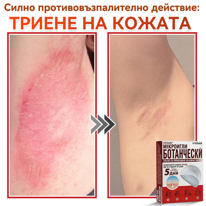 🎁 Остават само 5 пакета! Сега можете да получите допълнителна 50% ОТСТЪПКА! Помага видимо да се намалят фибромите, брадавиците и други кожни несъвършенства — бързо, удобно и безболезнено. 🌿